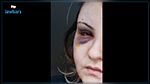تعرضت للعنف في الطريق العام ثم أصبحت متهمة : مواطنة تطلب من القضاء انصافها