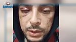 شاب تونسي: تعرّضت للعنف الشديد بعد رفضي تقديم رشوة لدورية أمنية (فيديو)