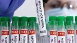 منظمة الصحة العالمية: الترخيص لاستخدام أوّل لقاح ضد جدري القردة للأطفال