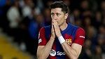 برشلونة يكشف طبيعة إصابة ليفاندوفسكي قبل أيام من مواجهة ريال مدريد