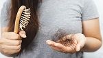 الصلع المبكر و الشيب.. دراسة تكشف عن أسباب غير متوقّعة !!