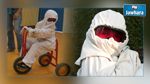أطفال القمر: أكثر من 800 حالة في تونس
