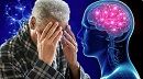 رئيس قسم الأعصاب بـ 