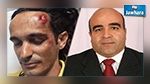 معتمد الحمامات يوضح أسباب اعتدائه على أجنبي مقيم بتونس