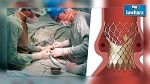 اتحاد الشغل يستنكر اجراءات وزارة الصحة بخصوص اللوالب القلبية منتهية الصلوحية