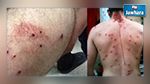 الرقاب : إصابة 14 شخصا بالرش خلال حفل زفاف