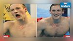 معجب ينقذ بطلا أولمبيا في السباحة من الإصابة بسرطان الجلد 