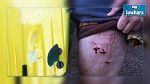استراليا : سمكة قرش تصيب راكب أمواج بجروح في ساقه 