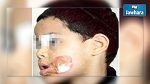 4 سنوات سجنا لعاملة الروضة التي أحرقت طفلا في وجهه