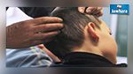 بنزرت : تسجيل 33 حالة إصابة بالقمل بمدرسة ابتدائية  