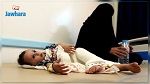 تفشي الكوليرا في اليمن يهدد حياة أكثر من مليون امرأة حامل