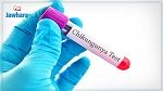 مخاوف في إيطاليا من انتشار فيروس شيكونغونيا
