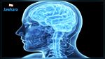 لأول مرة في التاريخ.. زرع جهاز في الدماغ لتقوية الذاكرة 