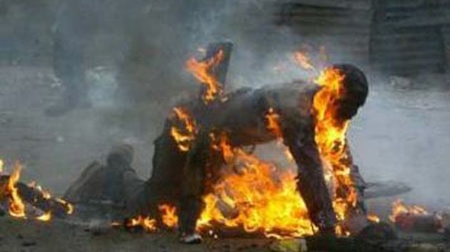 Djerba : Un jeune homme s'immole par le feu