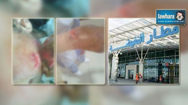 Aéroport Enfidha: Un chien de la birgade canine s'attaque à 2 femmes de ménage