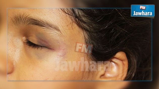 Tunis : Une enfant de 11 ans violentée par son instituteur