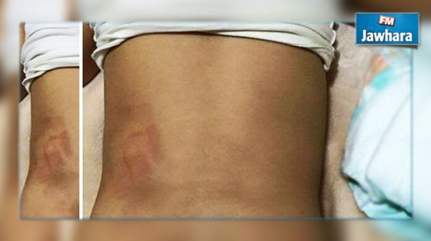 Sfax : Arrestation de l’animatrice d’une crèche ayant maltraité un enfant de 2 ans