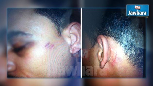 Sousse : Un réfugié syrien agressé à l'hôpital de Sahloul