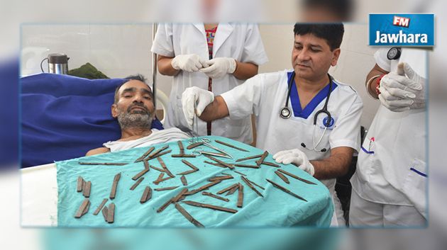Inde : Un homme opéré après avoir avalé 40 couteaux