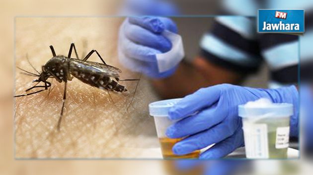 Zika : Un cas suspect de transmission par les larmes
