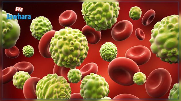 Cancer : La propagation des métastases est favorisée par les graisses