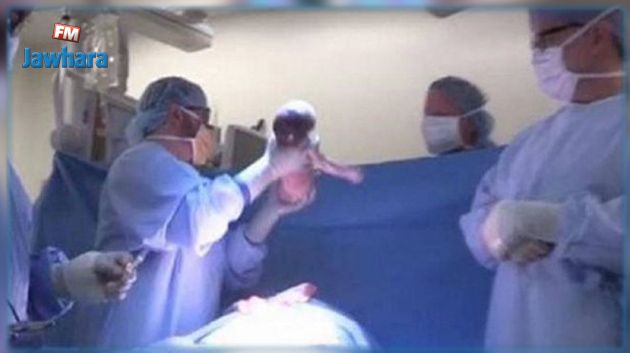 Etats-Unis : Une femme greffée d'un utérus accouche d'un bébé en bonne santé