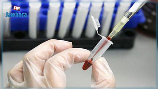 Santé : Inquiétude après “une pénurie” du test de HIV 