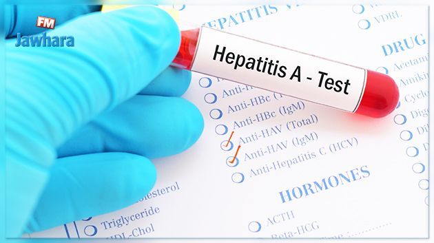 18 cas d'hépatite A enregistrés à Gabès : Mise au point du directeur régional de la santé