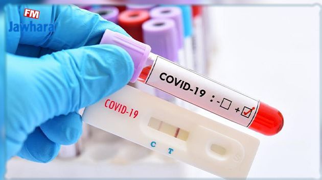 COVID-19 : 1474 nouvelles contaminations et 29 décès supplémentaires en une semaine