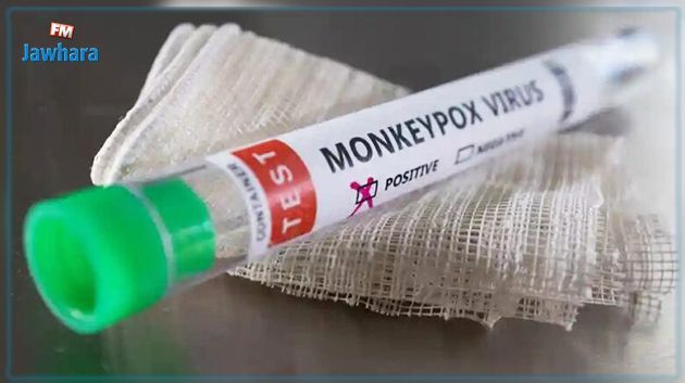 Un premier cas de variole du singe détecté en Russie