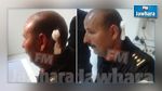 ASG-ESS : Un policier grièvement blessé à la tête par un jet de pierre