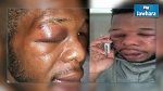 Le ministère de l'Enseignement supérieur dénonce l'agression d'un étudiant camerounais