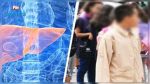 Décès d'une fillette atteinte d'Hépatite A à Sidi Bouzid : Suspension des cours, la médecine scolaire dans la ligne de mire