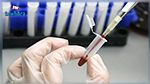 Santé : Inquiétude après “une pénurie” du test de HIV 