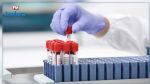 COVID19 : Le ministère de la Santé a retiré le cahier des charges de 8 laboratoires privés