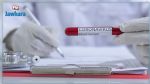 Covid-19 : 70 nouvelles contaminations détectées à la Manouba 