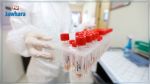 Il y a tout juste un an apparaissait le premier cas de coronavirus en Tunisie : Le point sur un triste bilan