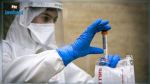 Covid-19 : 10 décès et 840 nouvelles contaminations, le taux de positivité en baisse
