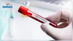 Nabeul-Covid19 : 20 nouvelles contaminations