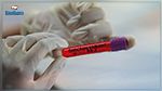 Covid-19 : Le sous-variant d'Omicron ne « provoque pas de forme plus grave », selon l'OMS