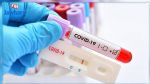 COVID-19 : 1474 nouvelles contaminations et 29 décès supplémentaires en une semaine